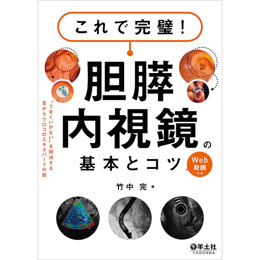 条件付 10 相当 これで完璧 胆膵内視鏡の基本とコツ うまくいかない を解決する目からウロコのエキスパートの技 Web動画つき 竹中完 Bk Bookfan 送料無料店 通販 Yahoo ショッピング