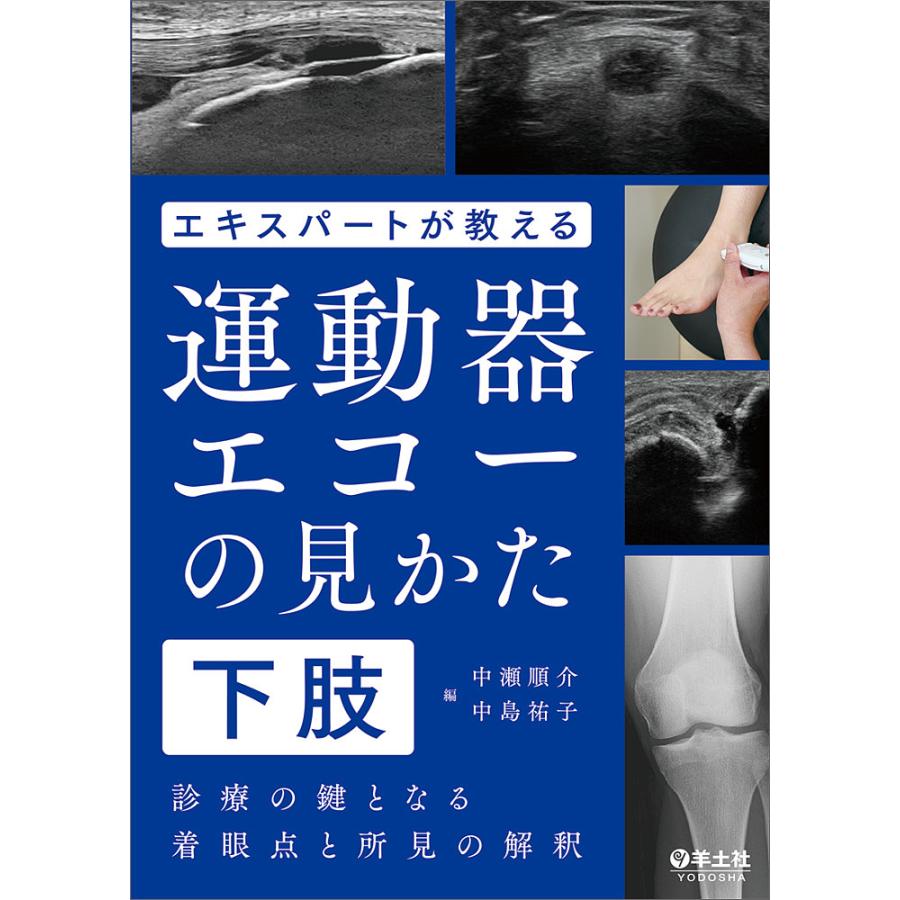 エキスパートが教える運動器エコーの見かた 診療の鍵となる着眼点と