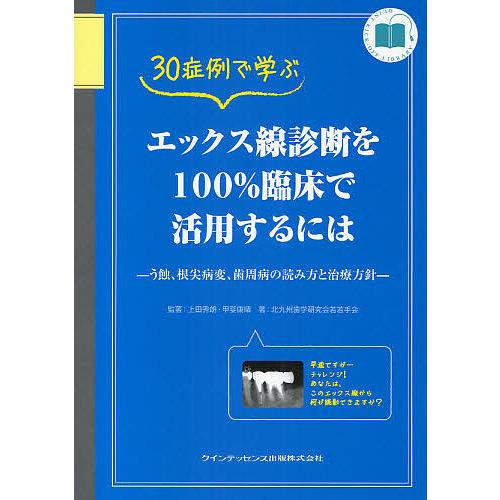 人気ブランドを 日曜はクーポン有 ３０症例で学ぶエックス線診断を１００ 臨床で活用するには う蝕 根尖病変 歯周病の読み方と治療方針 限定製作 Www Alquimiafestas Com Br