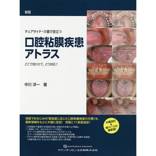 チェアサイド・介護で役立つ口腔粘膜疾患アトラス どこで見わけて