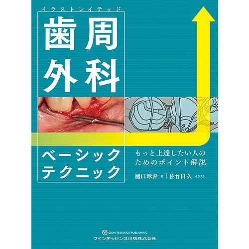 超目玉 イラストレイテッド歯周外科ベーシックテクニック もっと上達したい人のためのポイント解説 樋口琢善 佐竹田久 全ての Www Esiba Tg