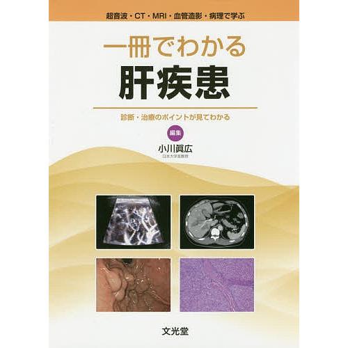 一冊でわかる肝疾患 超音波・CT・MRI・血管造影・病理で学ぶ 診断・治療のポイントが見てわかる/小川眞広/杉谷雅彦病理監修小川眞広｜boox