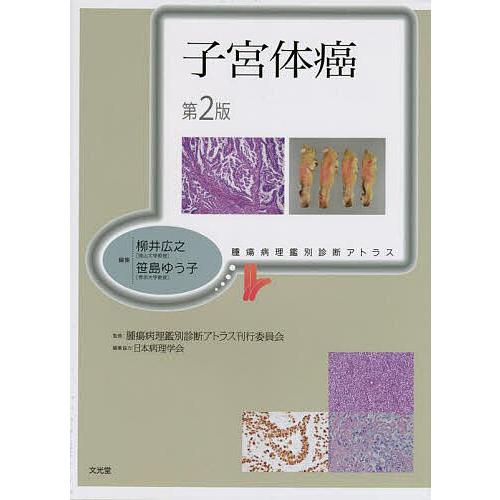 子宮体癌/柳井広之/笹島ゆう子/腫瘍病理鑑別診断アトラス刊行委員会