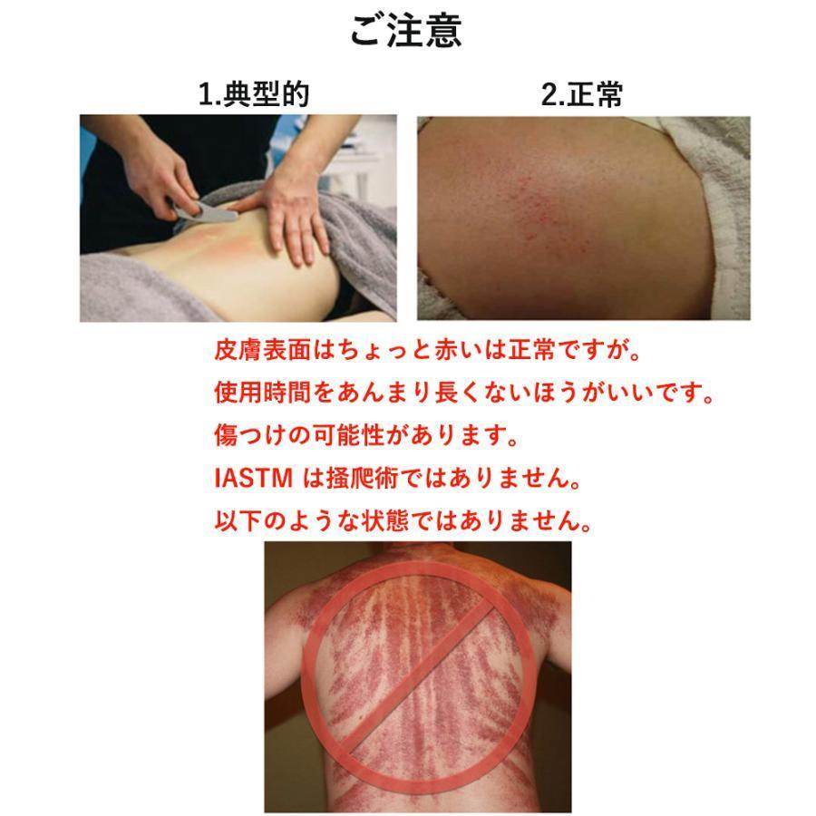 10％OFF】かっさプレート ステンレス マッサージツール 筋膜リリース