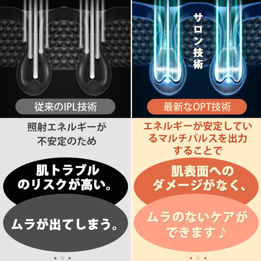 【期間限定12,000円OFFクーポン!! 6月4日(日)23:59まで】脱毛器 bosidin 光脱毛器 光美容器 2年保証つき 顔 ワキ