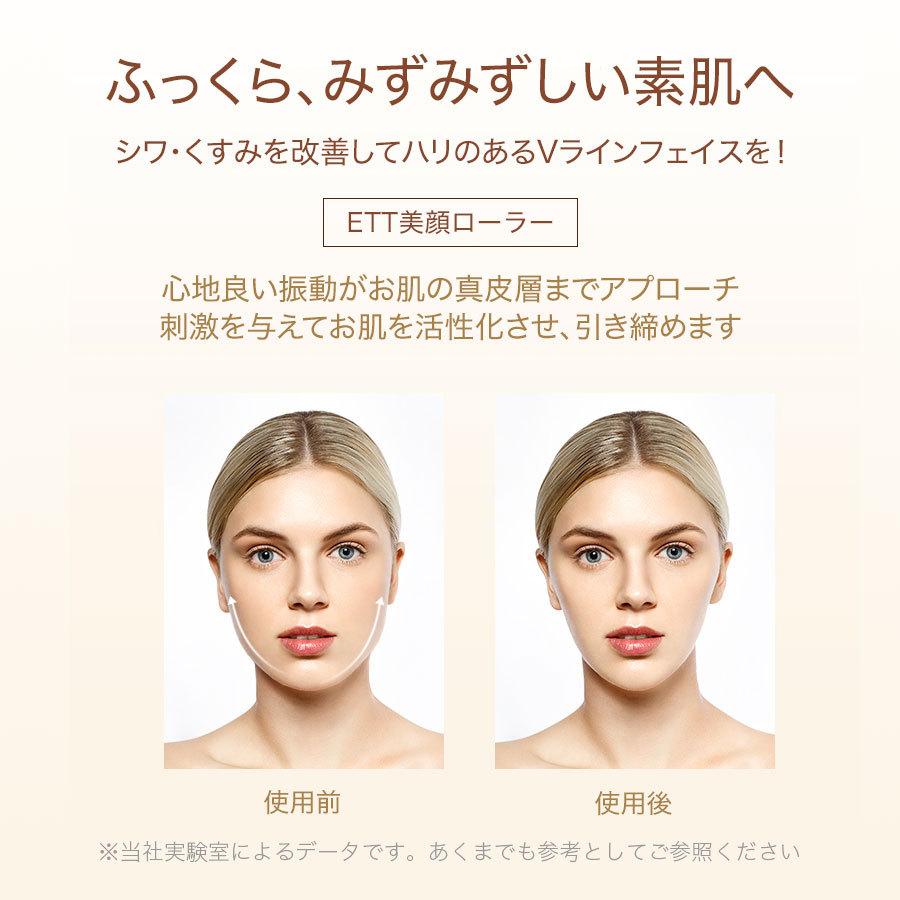 電動美顔ローラー 美顔器 24Kゴールド エステ スキンケア マッサージ 