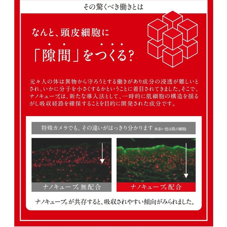 医薬部外品 育毛剤 女性用 フエリー 薬用 ヘアエッセンス 150mL (60