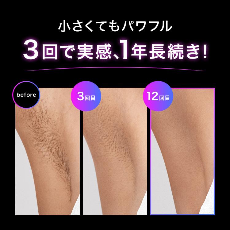 BRAUN 脱毛器 ケース付き ※動作確認済 ブラウン 光美容器 シルクエキスパート PL-3111