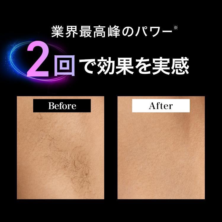 シルクエキスパート 【4/3新発売！】脱毛器・光美容器を手掛ける