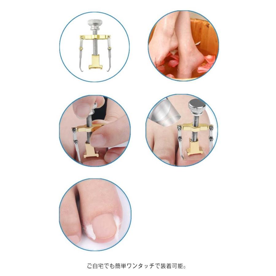 2個入り（収納ボックス付き） 足の巻き爪 防止 陥入爪 巻き爪 ネイル