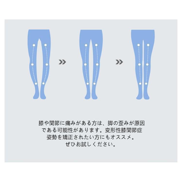 O脚矯正 X脚 インソール 中敷き O脚矯正インソール 1足セット 姿勢 O脚