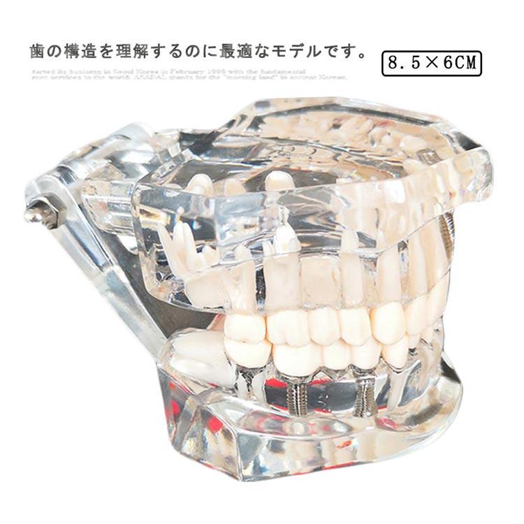 歯模型 透明 歯の模型 歯 模型 差し歯 歯医者 人体解剖モデル モデル