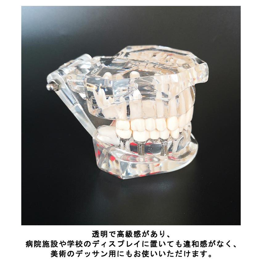 歯模型 透明 歯の模型 歯 模型 差し歯 歯医者 人体解剖モデル モデル