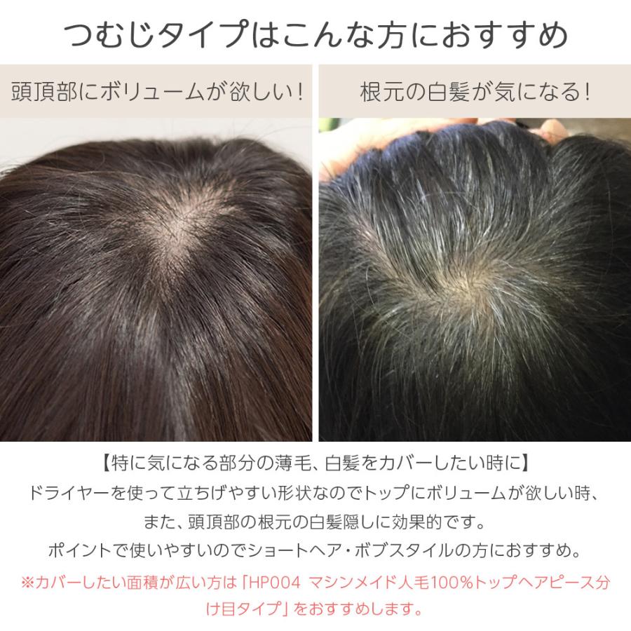 【人毛100%トップピースを期間限定！特別価格にてお譲りします】 総手植え 最高級レミー人毛100% リアルフィットスキン トップ