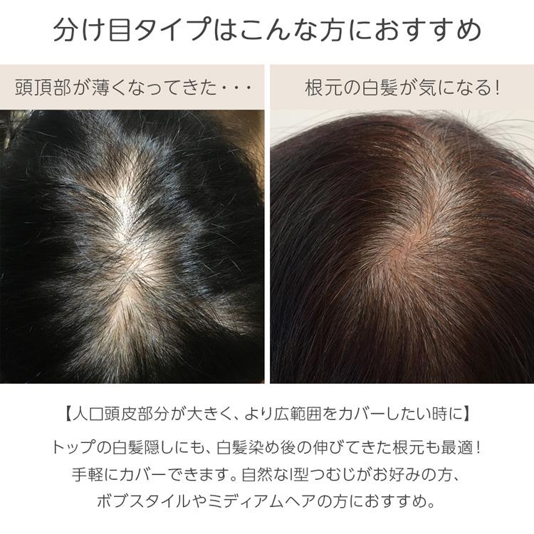 ヘアピース 人毛100% 人毛 100 ウィッグ トップカバー 部分ウィッグ 自然 トップヘアピース 人毛ウィッグ 医療用 かつら 医療用ウィッグ つけ毛｜brightlele｜13