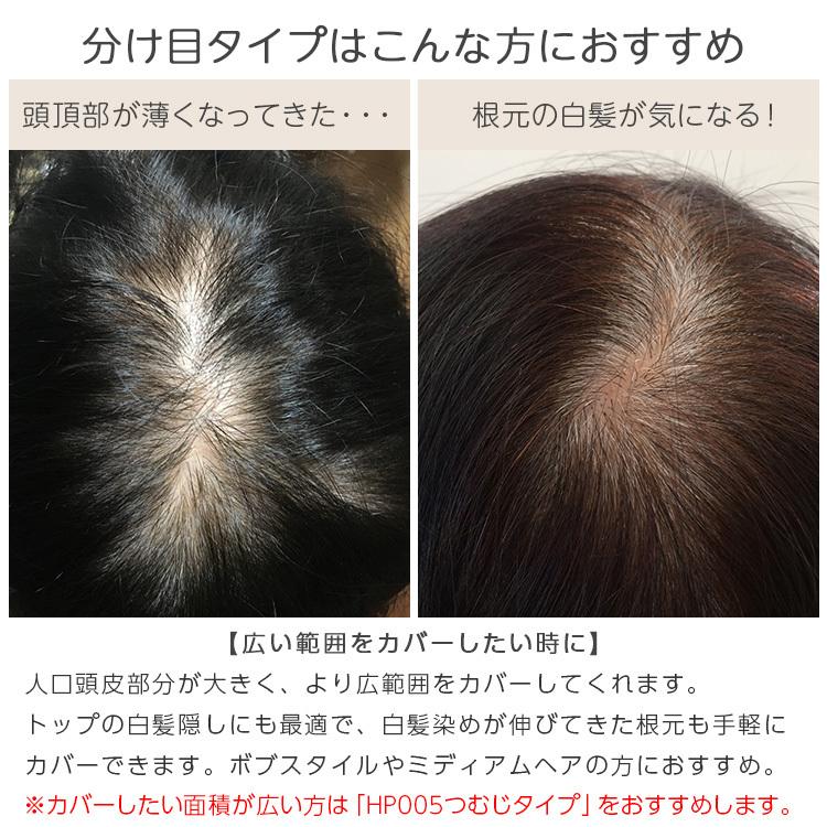 Brightlele 人毛100% 人毛 ウィッグ トップカバー 部分ウィッグ Brightlele 人毛100% 人毛 ウィッグ トップカバー 部分ウィッグ
