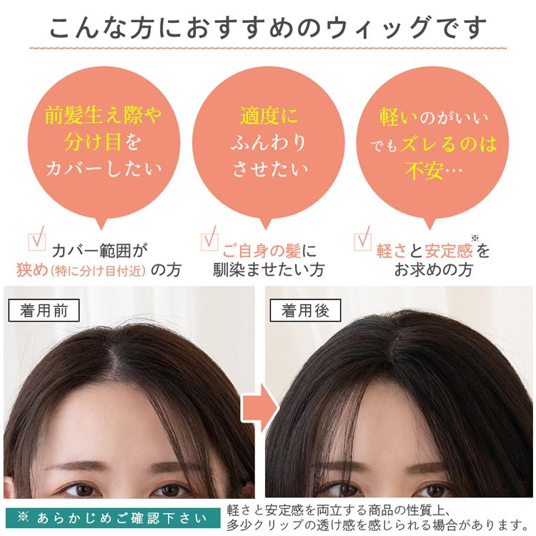 Brightlele（ブライトララ） トップカバー ウィッグ 生え際 ヘアピース