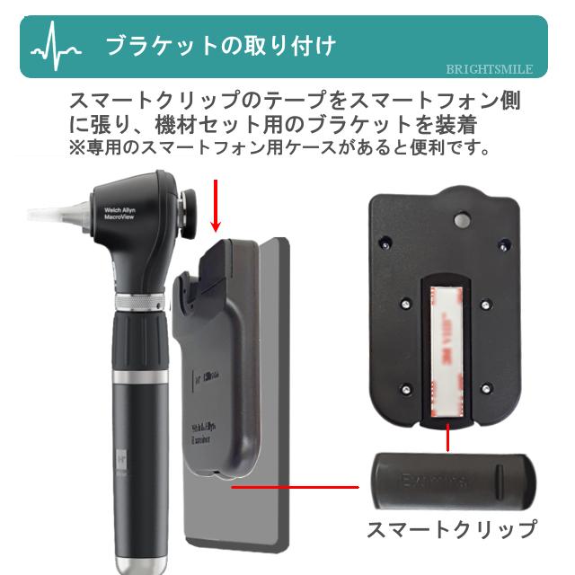 ウェルチ・アレン ケース付 ウェルチアレン LED 眼底鏡 耳鏡 ウェルチ・アレン ケース付 ウェルチアレン LED 眼底鏡 耳鏡