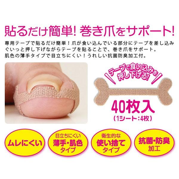 貼るだけ簡単！巻き爪をサポート 巻き爪ケアテープ : ビューティー