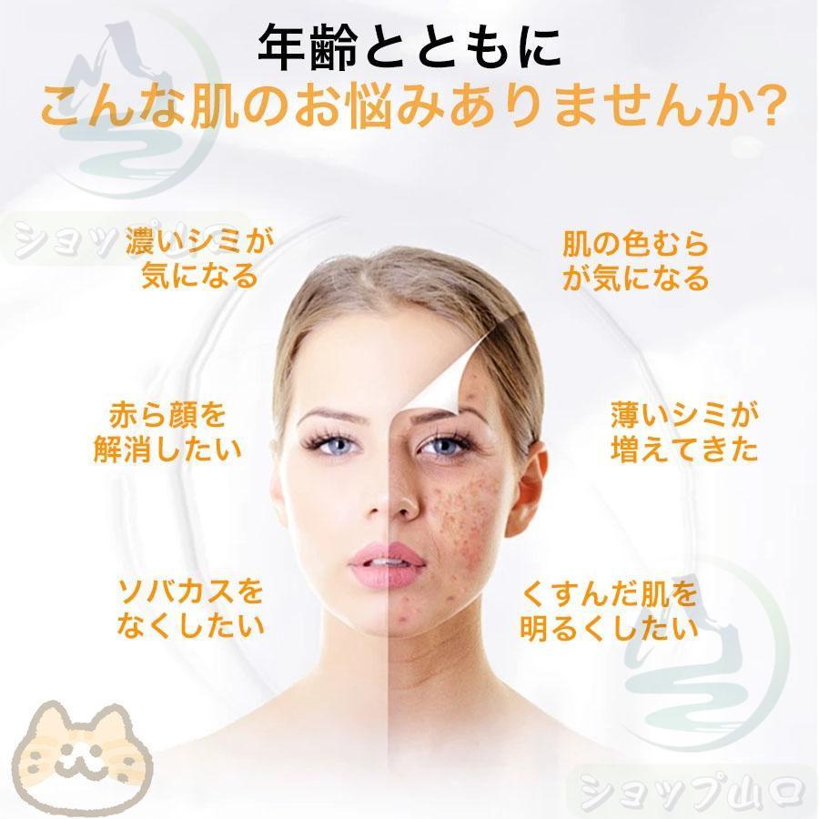 シミ取り美容美顔器 RU-638 シミ取り美容美顔器 RU-638 シミケア☆超