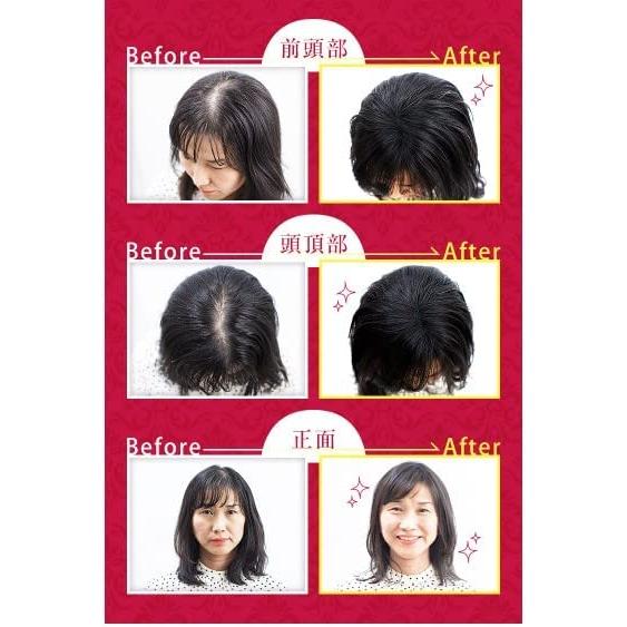 DOUDO ドウド ボリュームアップヘアスプレー 薄毛隠し ハゲ隠し DOUDO ドウド ボリュームアップヘアスプレー 薄毛隠し ハゲ隠し