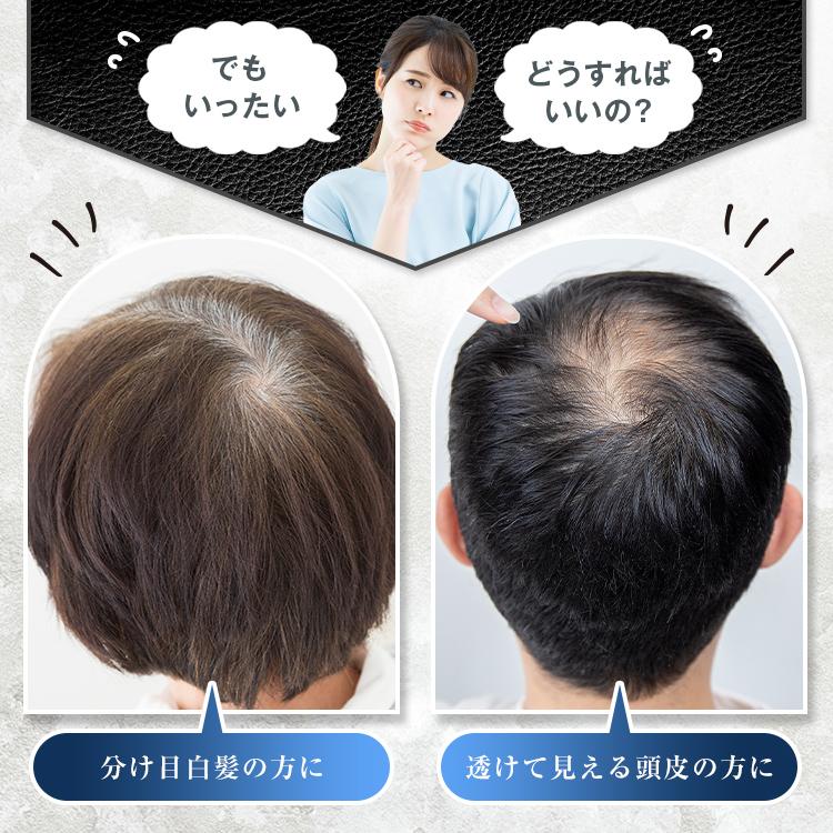 ニューモ ヘアパウダー・ヘアミスト各1本セット ダークブラウン ニューモ ヘアパウダー・ヘアミスト各1本セット ダークブラウン