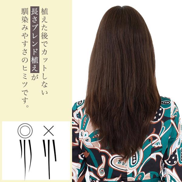 アクアドール 総手植え人毛100%ヘアピース リアルスキン ロングタイプ ahp017 (送料無料) トップピース トップカバー ウイッグ 白髪かくし ボリュームアップの画像