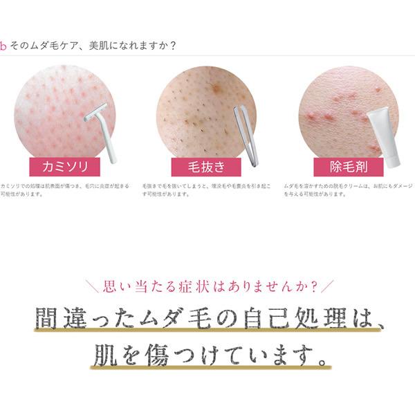 美ルル クリアベール ライト (送料無料) IPL フラッシュ式 脱毛器 家庭