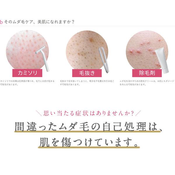 美ルル クリアベール (送料無料) IPL フラッシュ式 脱毛器 家庭用 自宅