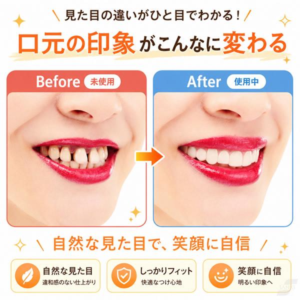 イエスミークイックティース (メール便送料無料) 付け歯 審美歯 仮歯 前歯 付け歯 つけ歯 ワンタッチ カバー 歯並び カバー フィッティングビーズ 薄型 男女兼用 | ブランド登録なし | 03