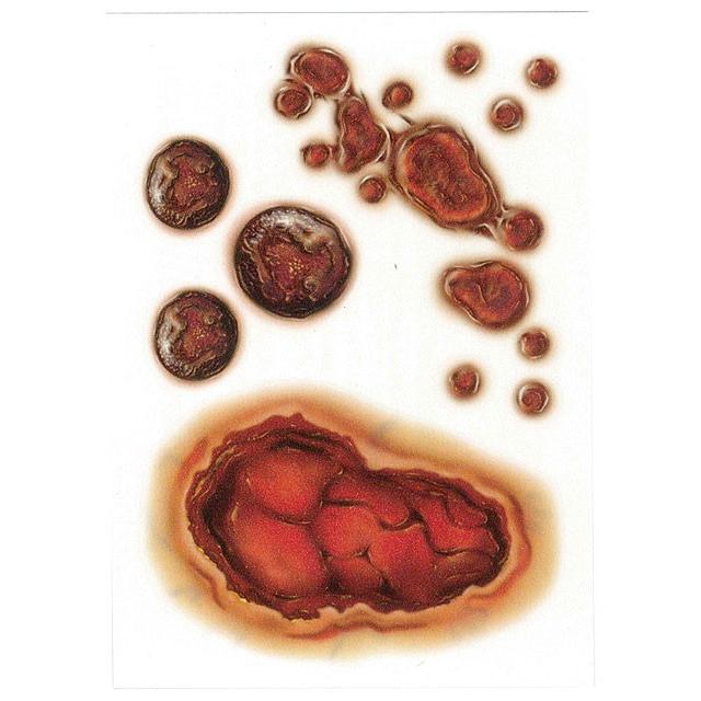 【即納】【在庫あり】キズとケガの特殊メイクシール　（ヤケド）　■　パーティー　飾り　アメリカ雑貨　店舗装飾　ハロウィン雑貨　仮装 |  | 04