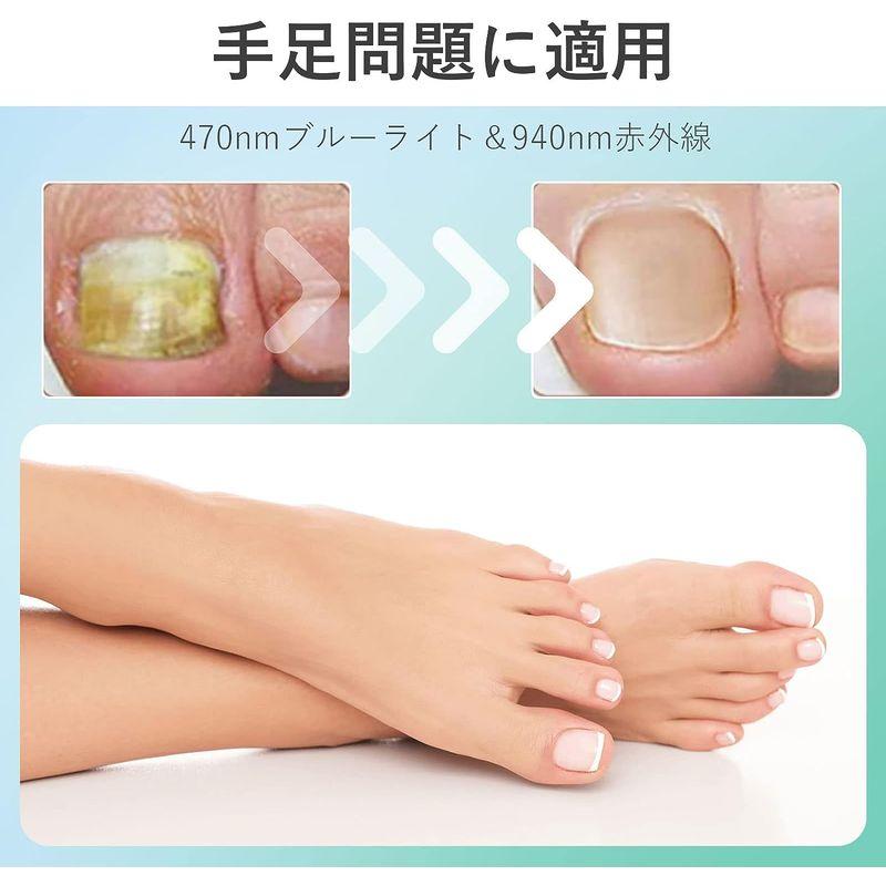 LLLT ネイルマシン スーパーライザー 470&905nm 爪ケア 足ケア ネイルクリーニングデバイス 青色光ライト 7分後に自動的にオフ ネイルマシン スーパーライザー 470&905nm 爪ケア 足ケア ネイルクリーニングデバイス 青色光ライト 7分後に自動的にオフ S1226599460(11438円)