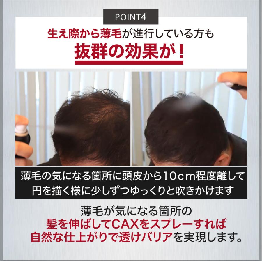 CAX 薄毛隠し 増毛スプレー 育毛剤や発毛剤と併用可 3本組 ハゲ