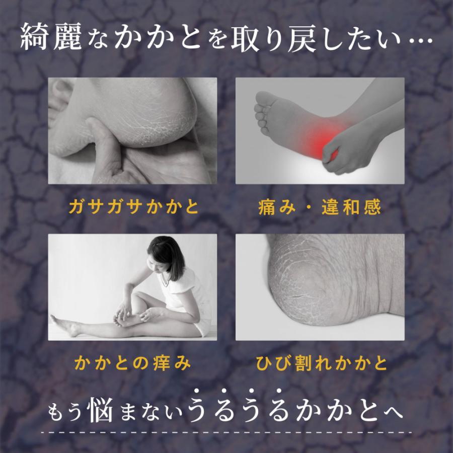 かかとうるるんシリコンパック かかとケア サポーター しっとり 保湿 ガサガサ ひび割れ 乾燥 角質 カサカサ 男女兼用 水洗いOK シリコン 衝撃吸収 かかと保護 | ブランド登録なし | 03