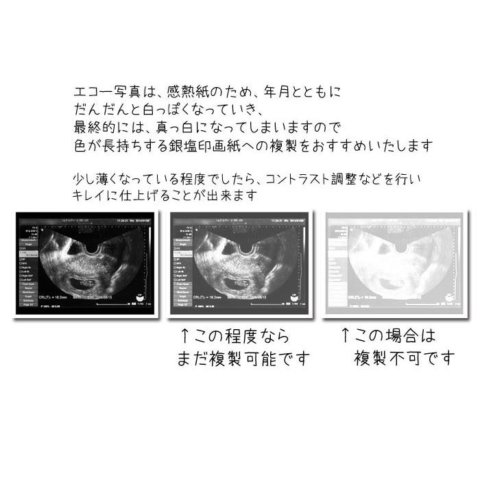 エコー写真の複製プリント 長期保存用プリント エコー写真保存 Echo01 写真のセントラル 通販 Yahoo ショッピング