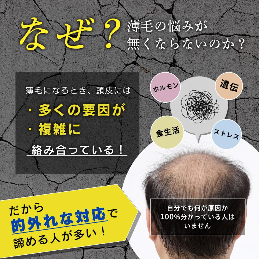 育毛剤 男性用 発毛 促進剤 薬用 育毛トニック メンズ ヘアトニック 養毛剤 育毛 スプレー 無香料 薄毛 抜け毛 低刺激 敏感肌 医薬部外品 ケフトル 120ml | ケフトルEX | 03