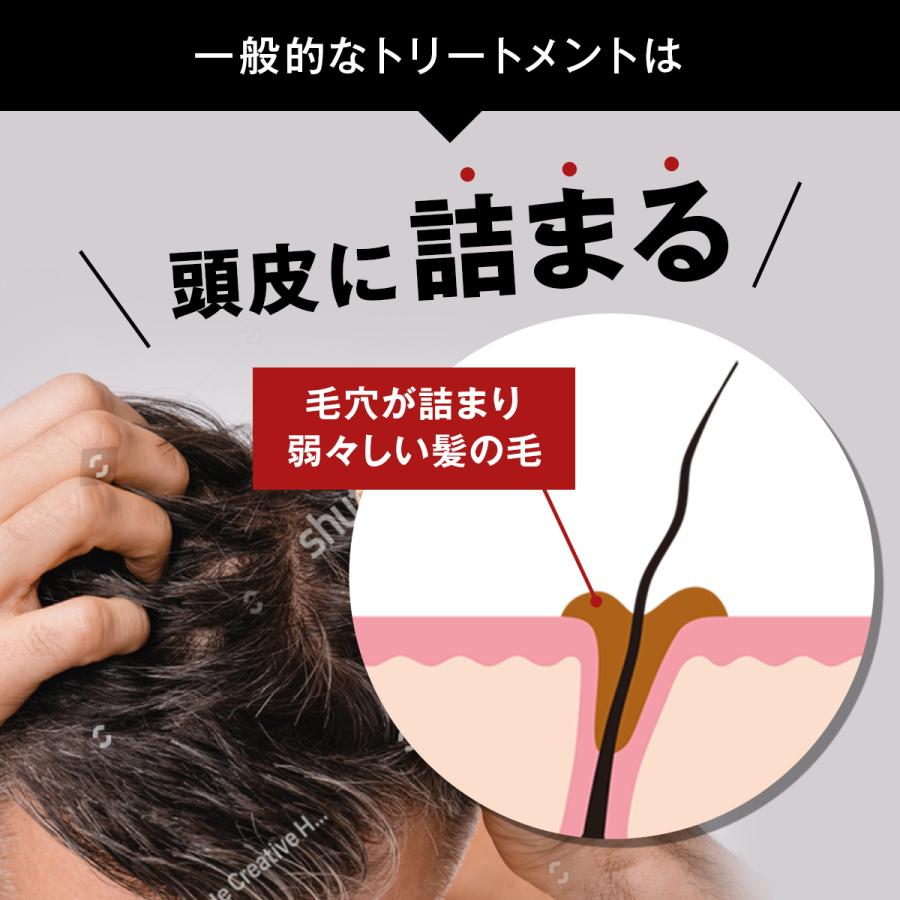 ケフトルEX スカルプコンディショナー eco 200g 単品 ケフトルEX スカルプコンディショナー eco 200g 単品