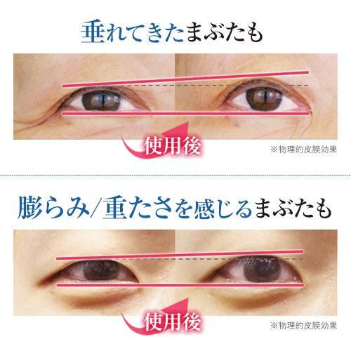 リッドキララ 10g 2セット 北の快適工房 まぶた専用美容 リッドキララ 10g 2セット 北の快適工房 まぶた専用美容