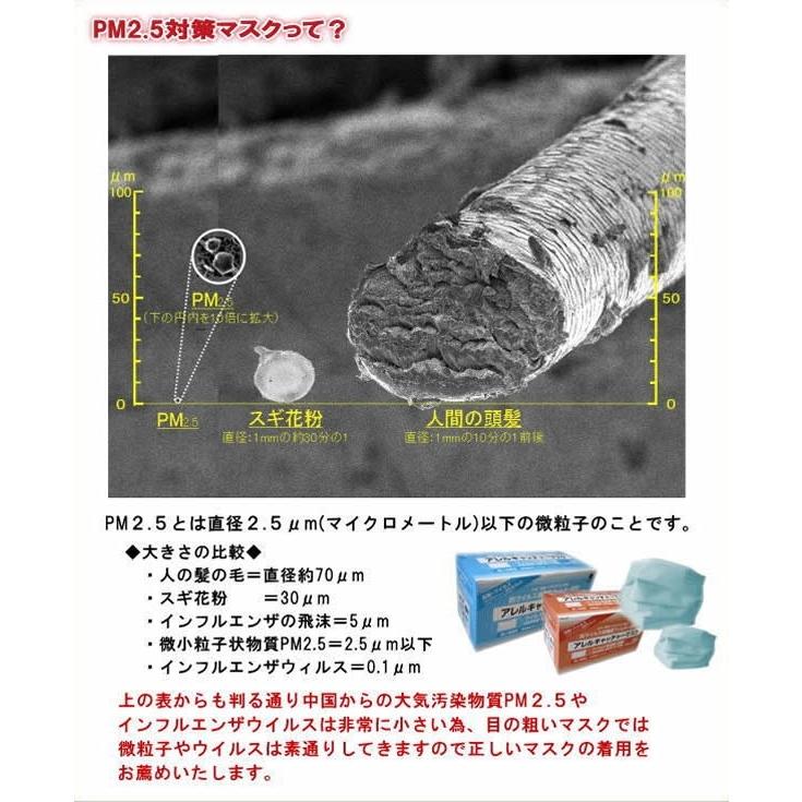 サージカルマスク 日本製 アレルキャッチャーマスク30枚入り 個包装