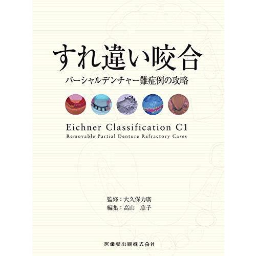 豪華 すれ違い咬合 パーシャルデンチャー難症例の攻略 0 激安特価 Www Technet 21 Org