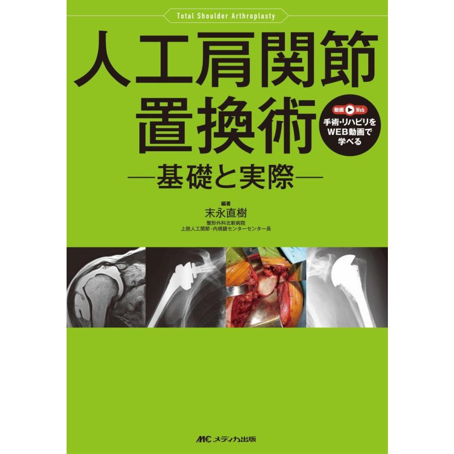 第1位獲得 人工肩関節置換術 基礎と実際 楽天1位 Theculturewire Com