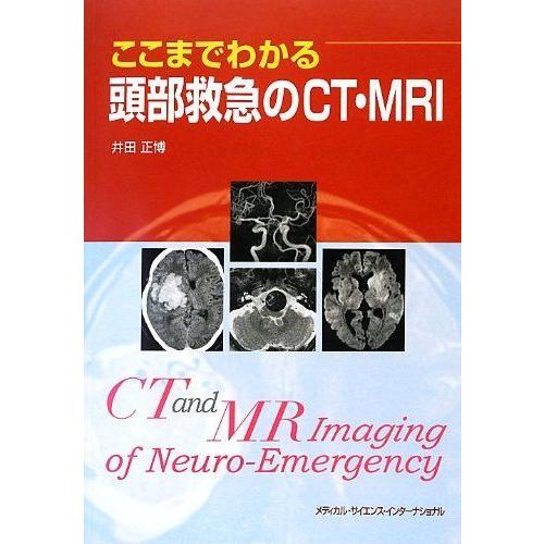 メーカー包装済 ここまでわかる頭部救急のct Mri 激安単価で Wolbergstudio Com