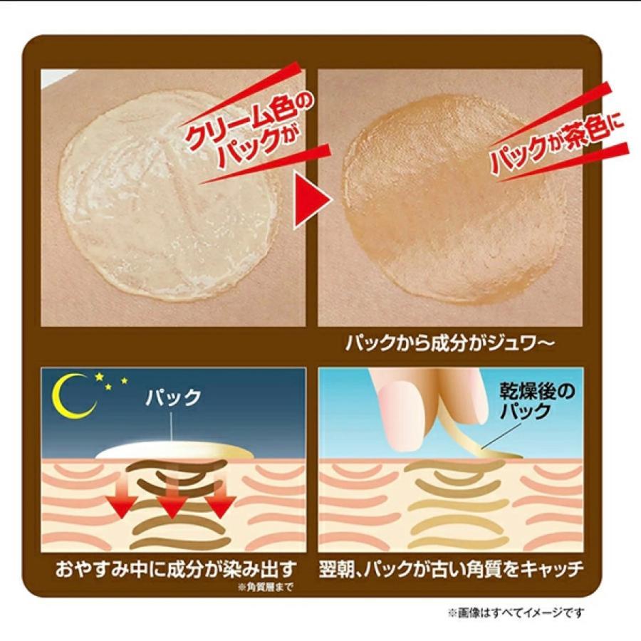 お得6個セット】 アトネールEX 15g 足の角質ケア クリーム パック 足
