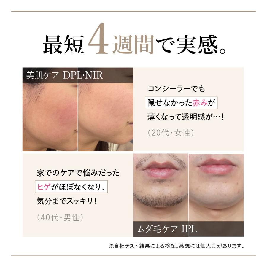 WAVEWAVE Radiant Grace ラディアント グレイス/脱毛 ムダ毛ケア IPL 3