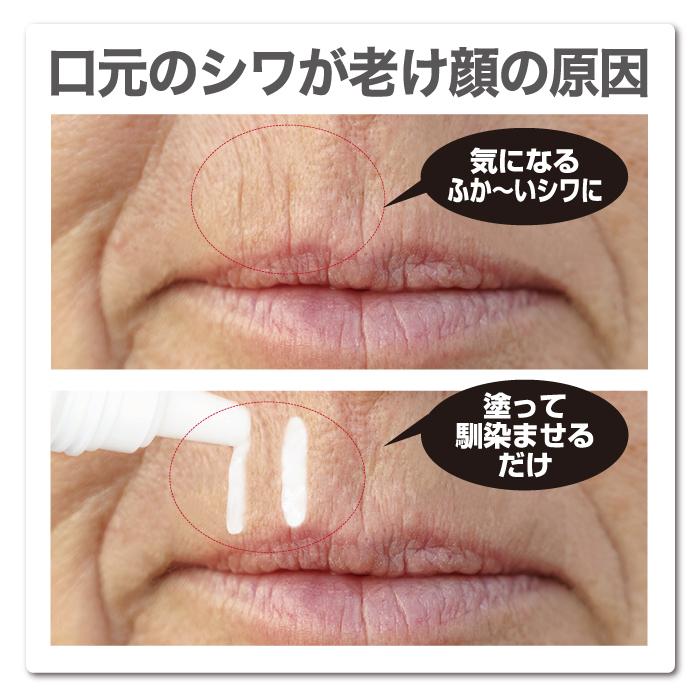 薬用シワピント 20g シワ改善 日本製 加齢ジワ 口元シワ タテジワ ほう