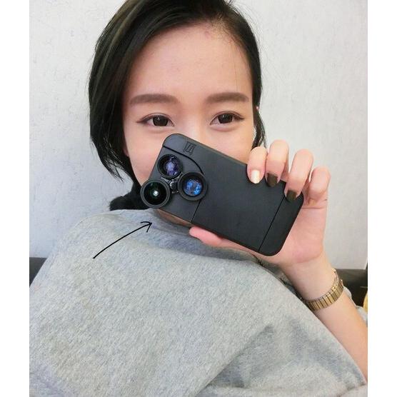 Iphone7plus用 4種のレンズ機能を搭載 カメラレンズ付きケース 一体型 撮影 写真 魚眼レンズ 広角レンズ ズーム 望遠レンズ マクロレンズ メール便不可 B665 直店 Com 通販 Yahoo ショッピング
