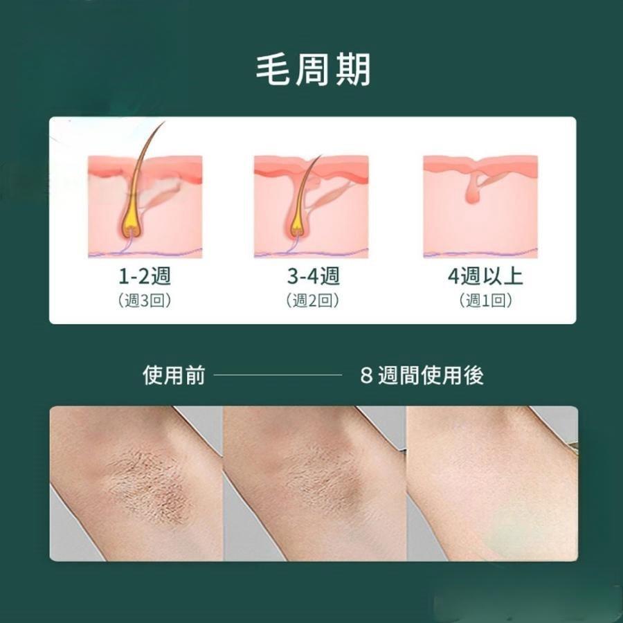 脱毛器 女性 レーザー 家庭用 メンズ ipl光脱器 無痛脱毛器 美容器