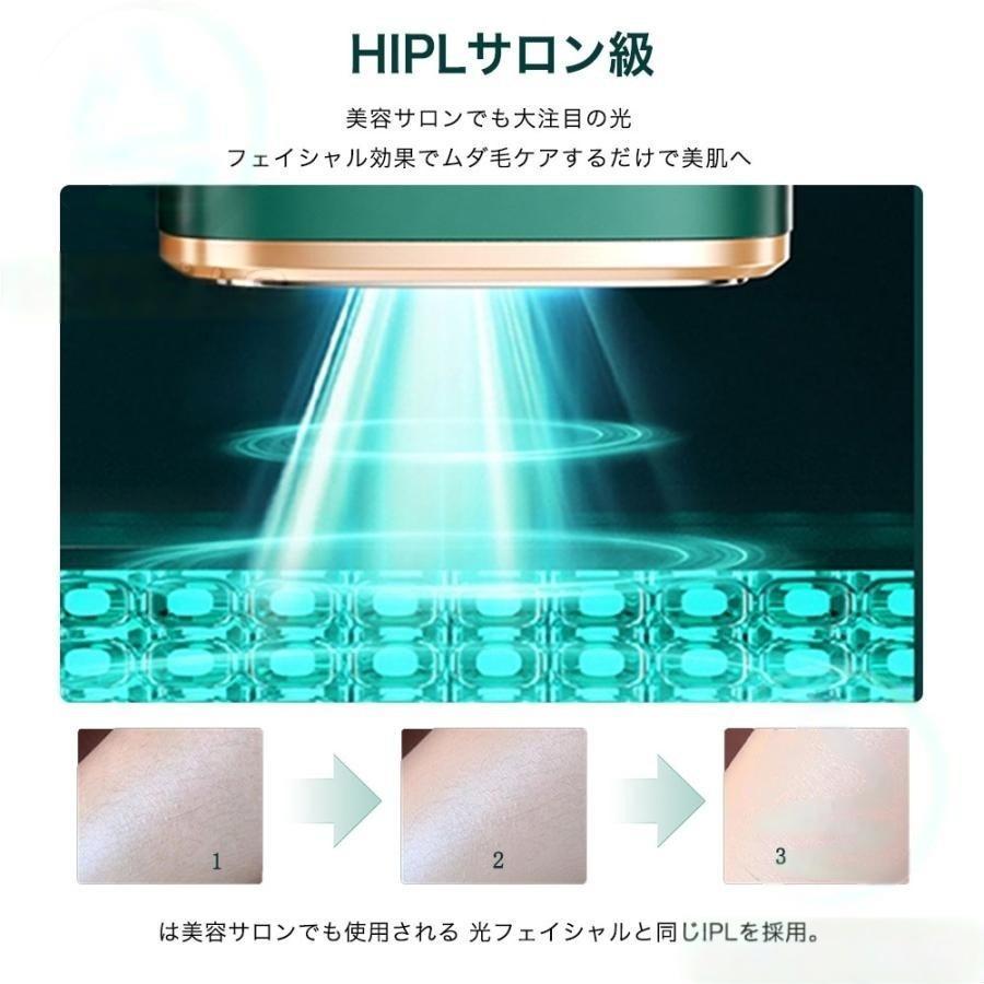 脱毛器 女性 レーザー 家庭用 メンズ ipl光脱器 無痛脱毛器 美容器 サロン級 5段階調節 自動照射 レーザー メンズ レディース vio対応 応援 母の日 新生活 2025 |  | 08