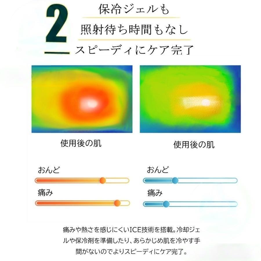 脱毛器 女性 レーザー 家庭用 メンズ ipl光脱器 無痛脱毛器 美容器 サロン級 5段階調節 自動照射 レーザー メンズ レディース vio対応 応援 母の日 新生活 2025 |  | 12