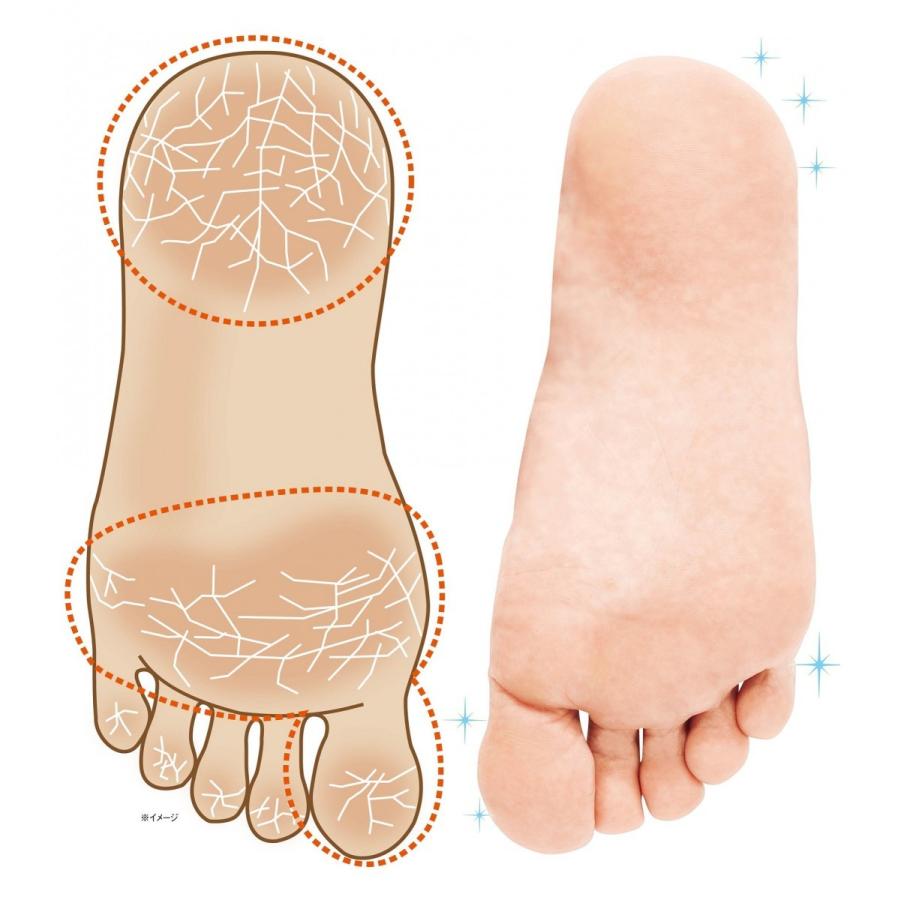 CLUEiD フットクリーム フットケア 角質 ピーリング かかと 踵